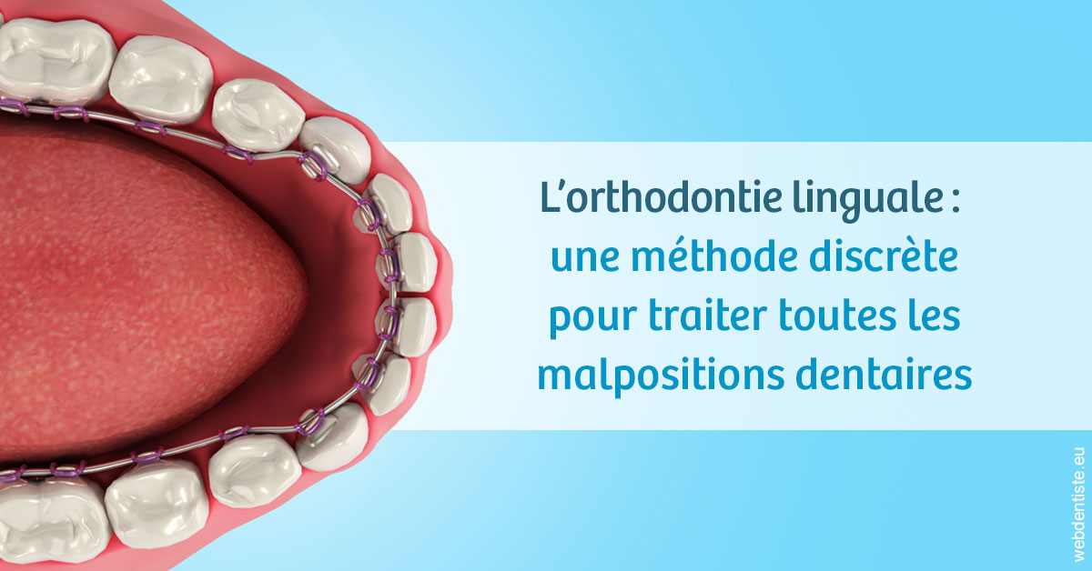 https://dr-sebbag-philippe.chirurgiens-dentistes.fr/L'orthodontie linguale 1