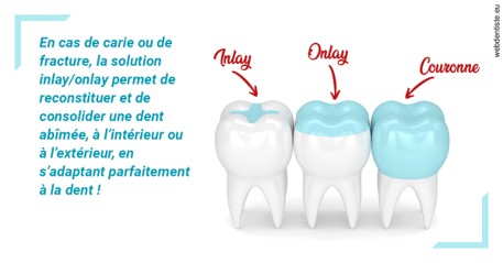 https://dr-sebbag-philippe.chirurgiens-dentistes.fr/L'INLAY ou l'ONLAY