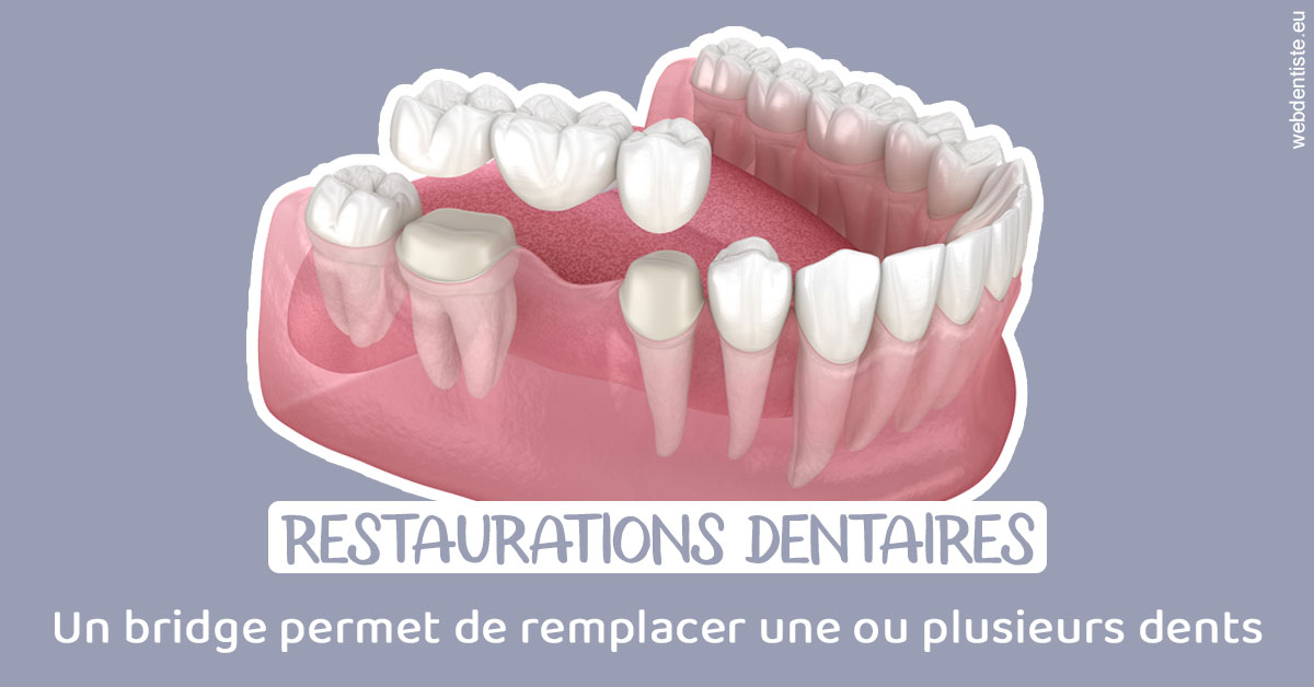 https://dr-sebbag-philippe.chirurgiens-dentistes.fr/Bridge remplacer dents 1
