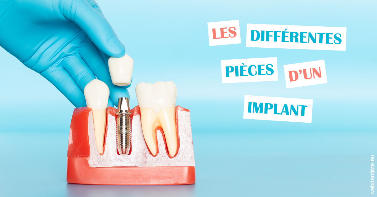 https://dr-sebbag-philippe.chirurgiens-dentistes.fr/Les différentes pièces d’un implant 2