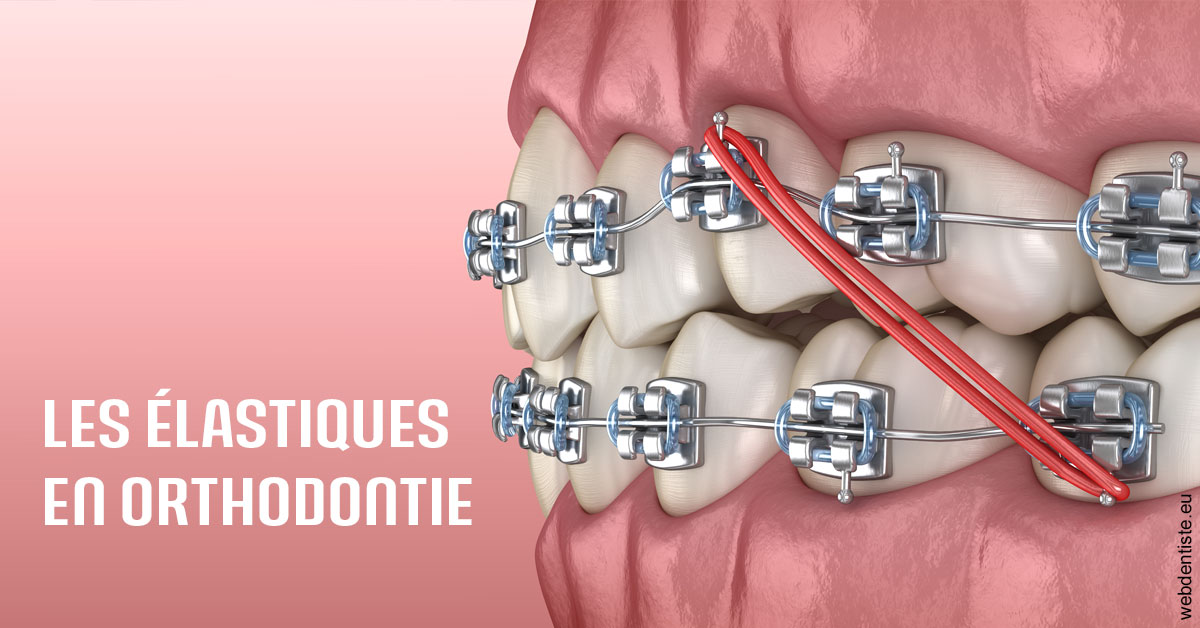 https://dr-sebbag-philippe.chirurgiens-dentistes.fr/Elastiques orthodontie 2