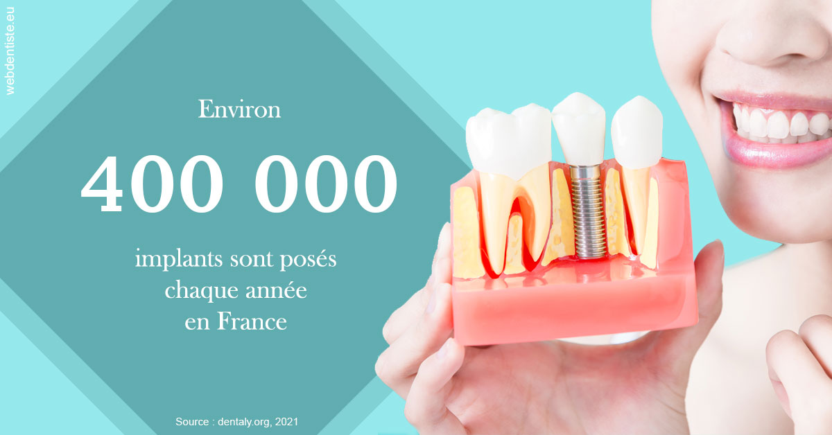 https://dr-sebbag-philippe.chirurgiens-dentistes.fr/Pose d'implants en France 2